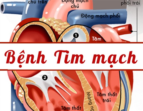 Điều trị bệnh tim như thế nào là hiệu quả?